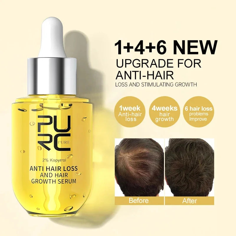 PURC™ Hair Growth Essential Oil